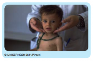 UNICEF - child getting health check.